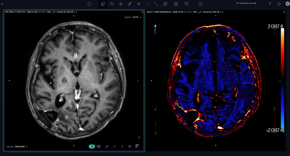 Arterys screenshot 2